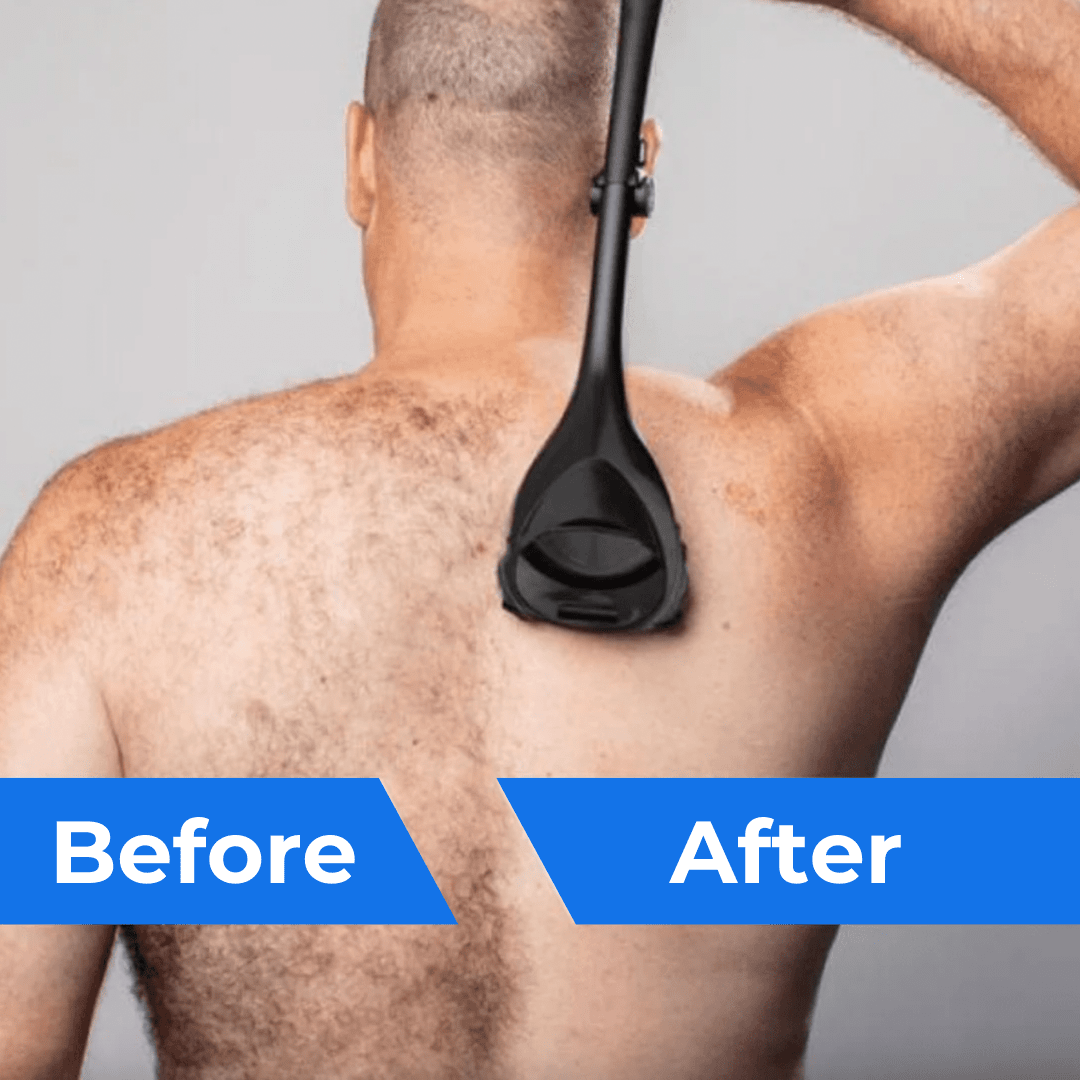 BodyBlayde™ - Original rygg- och kroppsrakapparat - Dossify